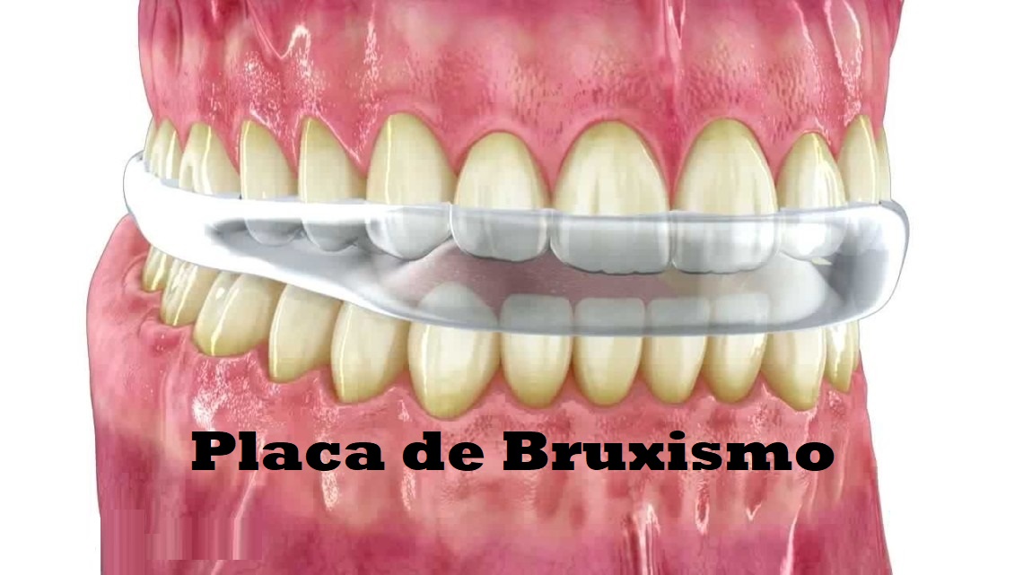 Placa Bruxismo 8589